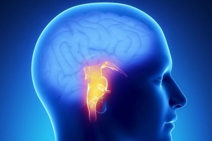 Everything to Know about Brain Strokes